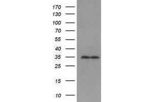 HEK293T cells were transfected with the pCMV6-ENTRY control (Left lane) or pCMV6-ENTRY GNB2L1 (Right lane) cDNA for 48 hrs and lysed. (GNB2L1 antibody)
