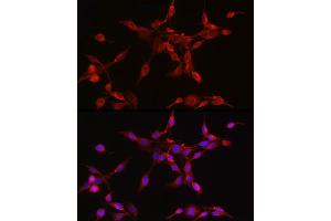 Immunofluorescence analysis of PC-12 cells using ORP1 Rabbit mAb (ABIN7269136) at dilution of 1:50 (40x lens). (OSBPL1A antibody)