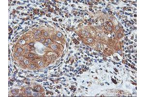 Image no. 10 for anti-IlvB (Bacterial Acetolactate Synthase)-Like (ILVBL) antibody (ABIN1498878)