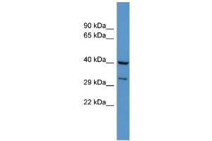 WB Suggested Anti-Dusp11 Antibody Titration: 0.