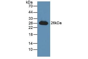 Detection of Recombinant GSTa3, Human using Polyclonal Antibody to Glutathione S Transferase Alpha 3 (GSTa3)