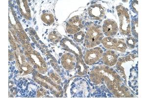 RNF165 antibody was used for immunohistochemistry at a concentration of 4-8 ug/ml to stain Epithelial cells of renal tubule (arrows) in Human Kidney. (RNF165 antibody  (Middle Region))