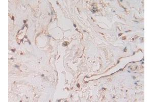 Immunohistochemistry (IHC) image for anti-beta-2-Microglobulin (B2M) (AA 22-119) antibody (ABIN7429220)