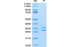 SDS-PAGE (SDS) image for IL-15/IL-15R (AA 31-108) protein (His tag,Biotin) (ABIN7274890)