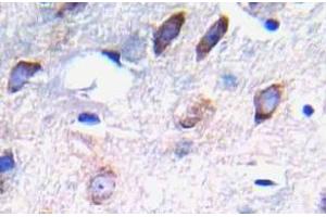 Immunohistochemistry (IHC) analyzes of p-PDGFR beta antibody in paraffin-embedded human brain tissue. (PDGFRB antibody  (pTyr751))