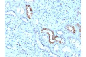 Formalin-fixed, paraffin-embedded human Kidney stained with Calbindin 1 Mouse Monoclonal Antibody (CALB1/3333). (CALB1 antibody  (AA 7-96))
