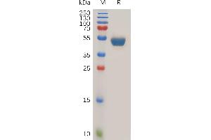 Human TN Protein, N-hFc Tag on SDS-PAGE under reducing condition.