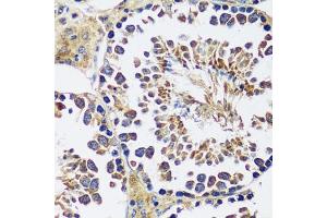 Immunohistochemistry of paraffin-embedded mouse testis using CCDC124 antibody  at dilution of 1:100 (40x lens). (CCDC124 antibody  (AA 1-223))