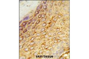 Formalin-fixed and paraffin-embedded human skin tissue reacted with LDHA Antibody , which was peroxidase-conjugated to the secondary antibody, followed by DAB staining.