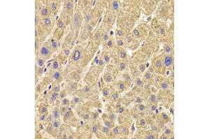 Immunohistochemistry of paraffin-embedded human liver injury using PEX5 antibody (ABIN5973402) at dilution of 1/100 (40x lens). (PEX5 antibody)