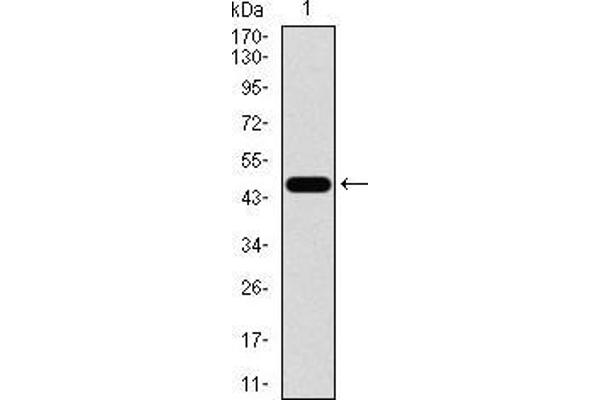CBX8 抗体  (AA 17-222)