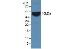 Detection of Recombinant VCAM1, Rabbit using Monoclonal Antibody to Vascular Cell Adhesion Molecule 1 (VCAM1) (VCAM1 antibody  (AA 409-682))