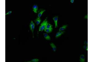 Immunofluorescence staining of Hela cells with ABIN7164700 at 1:33, counter-stained with DAPI. (HBEGF antibody  (AA 63-148))
