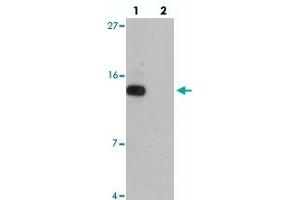 Western blot analysis of DDA1 in mouse heart tissue with DDA1 polyclonal antibody  at 1 ug/mL in (lane 1) the absence and (lane 2) the presence of blocking peptide.