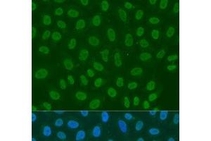 Immunofluorescence analysis of U2OS cells using LSM2 Polyclonal Antibody at dilution of 1:100.