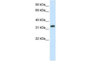 WB Suggested Anti-SIAH1 Antibody Titration:  1. (SIAH1 antibody  (C-Term))