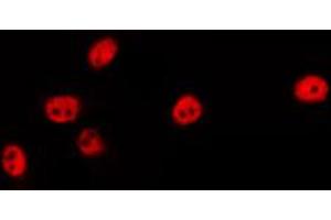 ABIN6274457 staining LOVO by IF/ICC. (EZH1 antibody  (Internal Region))