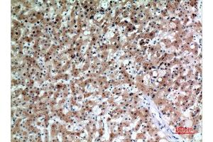 Immunohistochemistry (IHC) analysis of paraffin-embedded Human Liver, antibody was diluted at 1:100. (CEACAM5 antibody  (Internal Region))