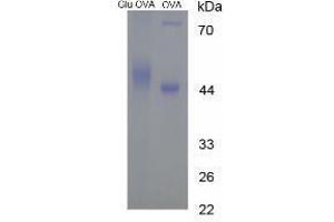 Image no. 3 for Glutamic Acid peptide (Ovalbumin) (ABIN5666204) (Glutamic Acid peptide (Ovalbumin))