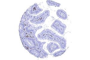 IgA positive plasma cells are abundant in the duodenum mucosa (Recombinant Rabbit anti-Human IgA Antibody)