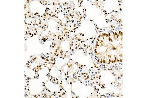 Immunohistochemistry (IHC) image for anti-K(lysine) Acetyltransferase 2A (KAT2A) (AA 1-100) antibody (ABIN1679964)