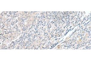 POMGNT1 antibody
