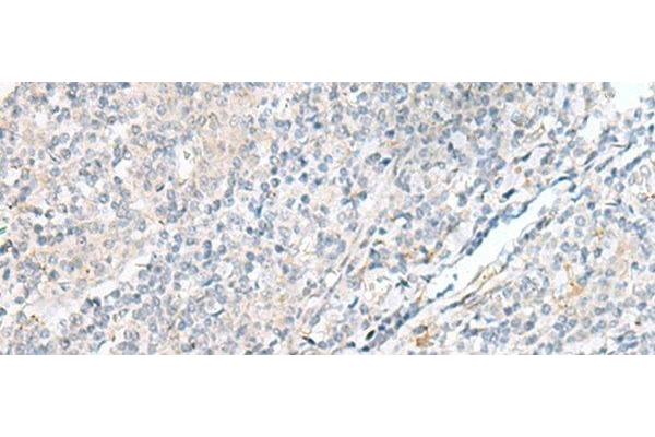 POMGNT1 antibody