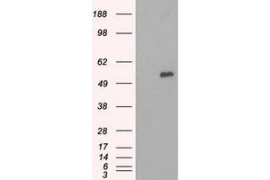 Western Blotting (WB) image for anti-Solute Carrier Family 7 (Amino Acid Transporter, L-Type), Member 8 (SLC7A8) antibody (ABIN1500965) (SLC7A8 antibody)
