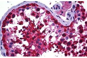 Human Testis: Formalin-Fixed, Paraffin-Embedded (FFPE) (CCT5 antibody  (AA 1-542))