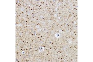 Immunohistochemistry of paraffin-embedded rat brain using Caspase-6 Rabbit mAb (ABIN7266119) at dilution of 1:100 (40x lens). (Caspase 6 antibody)