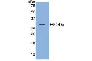 Detection of Recombinant KLK5, Mouse using Polyclonal Antibody to Kallikrein 5 (KLK5) (Kallikrein 5 antibody  (AA 25-261))