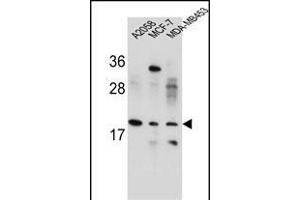 VCX1/VCX2/VCX3 Antibody (N-term) (ABIN654781 and ABIN2844462) western blot analysis in ,MCF-7,MDA-M cell line lysates (35 μg/lane). (VCX antibody  (N-Term))