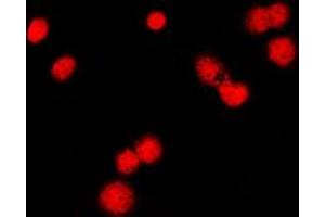 Immunofluorescent analysis of MSH6 staining in HeLa cells. (MSH6 antibody  (Center))