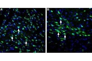 Expression of LRRK2 in rat striatum and substantia nigra - Immunohistochemical staining of perfusion-fixed frozen rat brain sections using Anti-LRRK2 Antibody (ABIN7044716 and ABIN7044717), (1:400), followed by goat-anti-rabbit-AlexaFluor-488 secondary antibody.