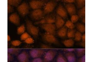 Immunofluorescence analysis of HeLa cells using CEP85 Polyclonal Antibody at dilution of 1:100. (CEP85 antibody)