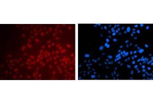 Immunofluorescence Microscopy of Mouse anti-PAX6 antibody. (PAX6 antibody)