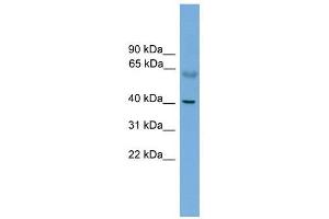 PRKACA antibody used at 1 ug/ml to detect target protein. (PRKACA antibody  (N-Term))