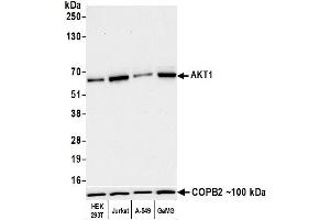 Western Blotting (WB) image for anti-V-Akt Murine Thymoma Viral Oncogene Homolog 1 (AKT1) (AA 100-150) antibody (ABIN7795634) (Recombinant AKT1 antibody  (AA 100-150))