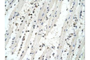 TRIM32 antibody was used for immunohistochemistry at a concentration of 4-8 ug/ml. (TRIM32 antibody  (C-Term))