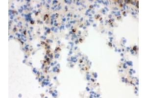 IHC testing of frozen mouse lung tissue with Lipocalin 2 antibody.