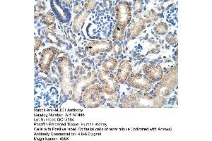 Immunohistochemistry (IHC) image for anti-Mucin 1 (MUC1) (C-Term) antibody (ABIN2776819)