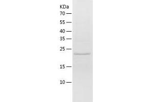 Western Blotting (WB) image for Regulator of G-Protein Signaling 2 (RGS2) (AA 1-211) protein (His tag) (ABIN7286116) (RGS2 Protein (AA 1-211) (His tag))