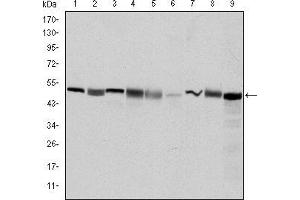 Western blot analysis using CCT2 mouse mAb against Hela (1), MCF-7 (2), Jurkat (3), T47D (4), K562 (5), A431 (6), NIH/3T3 (7), PC-12 (8) and Cos7 (9) cell lysate.