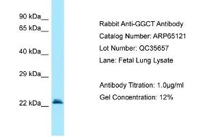 Western Blotting (WB) image for anti-gamma-Glutamylcyclotransferase (GGCT) (C-Term) antibody (ABIN2790049) (GGCT antibody  (C-Term))