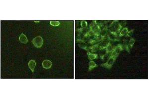 Immunofluorescence staining of methanol-fixed A431 (left) and Hela (right) cells showing cytoplasmic and membrane localization. (MAPK10 antibody  (AA 28-233))