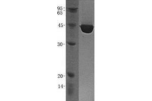 Validation with Western Blot (CPB1 Protein (GST tag))