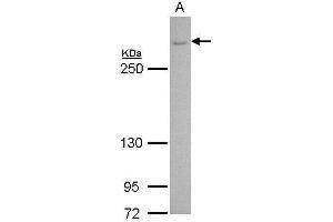 WB Image CACNA1B antibody [C3], C-term detects CACNA1B protein by Western blot analysis. (CACNA1B antibody  (C-Term))
