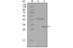 Western Blot showing ESR1 antibody used against truncated Trx-ESR1 recombinant protein (1) and truncated ESR1 (aa130-339)-His recombinant protein (2). (Estrogen Receptor alpha antibody  (AA 130-339))