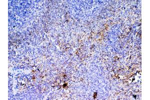 IHC analysis of PF4 using anti-PF4 antibody . (PF4 antibody  (AA 30-105))