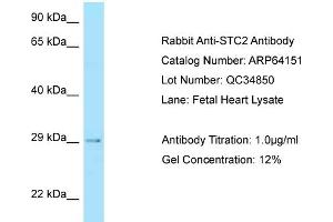 Western Blotting (WB) image for anti-Stanniocalcin 2 (STC2) (C-Term) antibody (ABIN2789750) (Stanniocalcin 2 antibody  (C-Term))